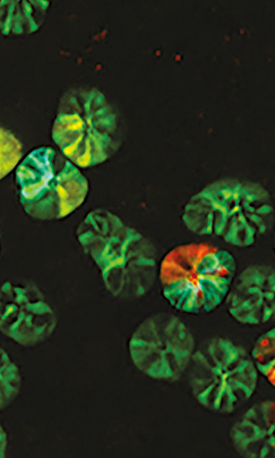 Frontaler Ausschnitt der Darmkrypten mit den dazugehörigen Stammzellen. Foto: Jacco Van Rheenen "Intravital microscopy of cancer" NKI Lab