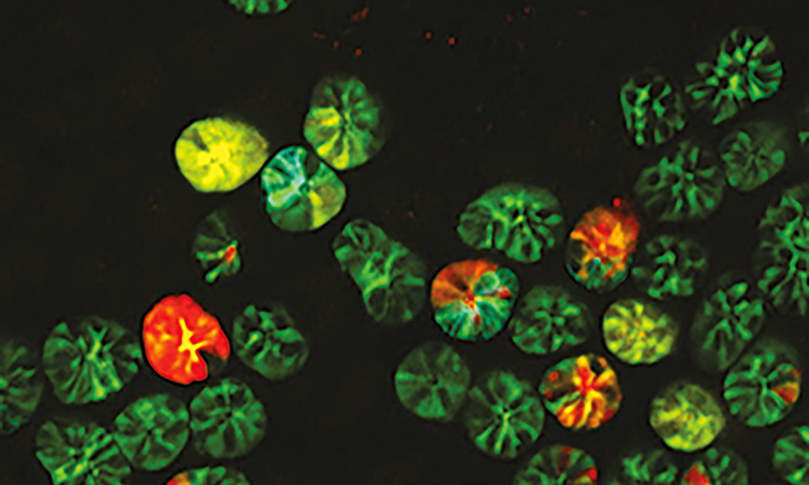 Frontaler Ausschnitt der Darmkrypten mit den dazugehörigen Stammzellen. Foto: Jacco Van Rheenen "Intravital microscopy of cancer" NKI Lab