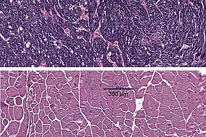 Schaltet man einen bestimmten Entzündungsmarker im Körper aus, könnte das das Ende der Kachexie bedeuten - zumindest in bestimmten Fällen, wie beim Fibrosarkom. Am Bild sieht man entartete Muskelzellen (oben) und einen gesunden Muskel im Vergleich (unten). Fotonachweis: Pototschnig et al., JCSM, 2022