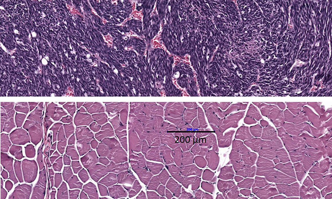 Schaltet man einen bestimmten Entzündungsmarker im Körper aus, könnte das das Ende der Kachexie bedeuten - zumindest in bestimmten Fällen, wie beim Fibrosarkom. Am Bild sieht man entartete Muskelzellen (oben) und einen gesunden Muskel im Vergleich (unten). Fotonachweis: Pototschnig et al., JCSM, 2022
