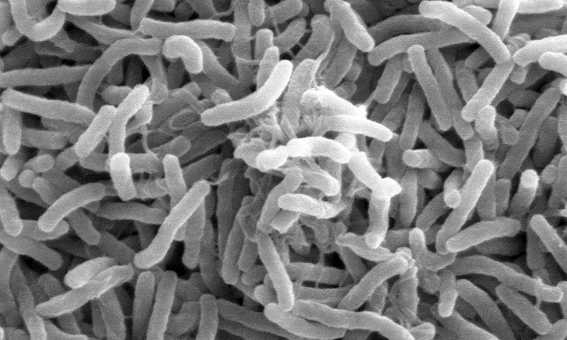 Cholera-Bakterien unter dem Mikroskop: Wie sich die Krankheitserreger Nahrung verschaffen, haben WissenschafterInnen der Uni Graz nun geklärt. Foto: Wikimedia Commons