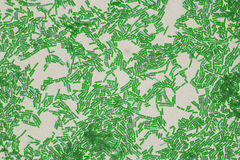 Bakterien der Gattung Bacillus liefern einen Biokatalysator für ein neues Verfahren zur Herstellung des wichtigsten Nylonbausteins. Foto: Dr. Sahay, <a href="http://upload.wikimedia.org/wikipedia/commons/9/9f/Bacillus_species.jpg">Wikimedia Commons</a>