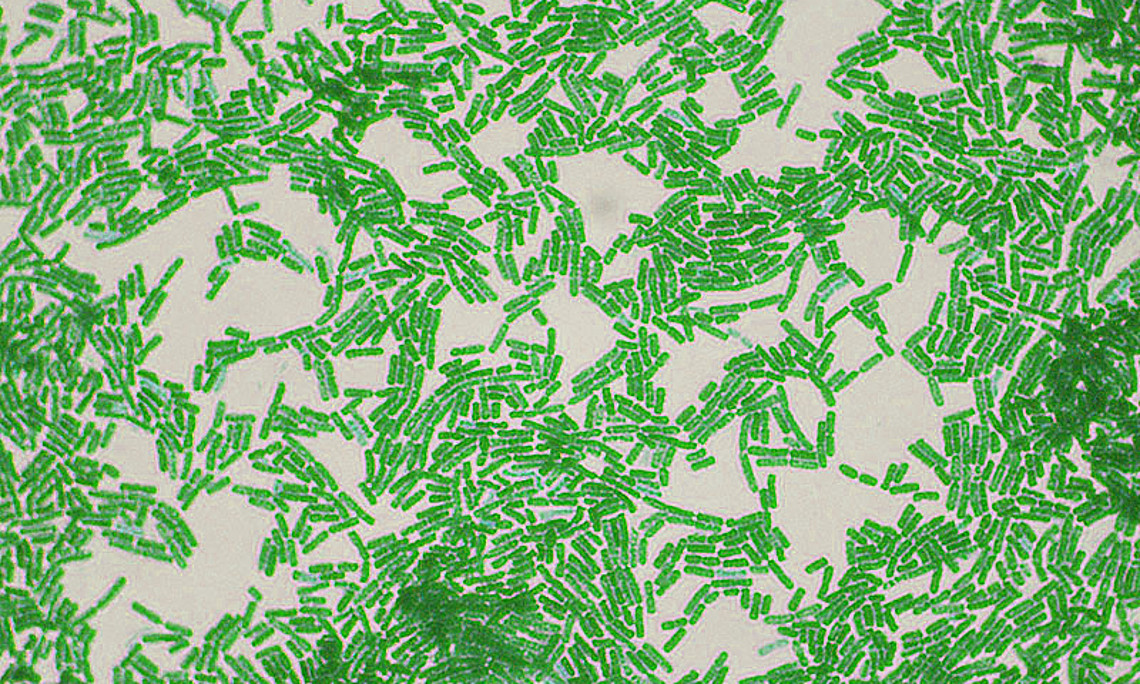 Bakterien der Gattung Bacillus liefern einen Biokatalysator für ein neues Verfahren zur Herstellung des wichtigsten Nylonbausteins. Foto: Dr. Sahay, <a href="http://upload.wikimedia.org/wikipedia/commons/9/9f/Bacillus_species.jpg">Wikimedia Commons</a>