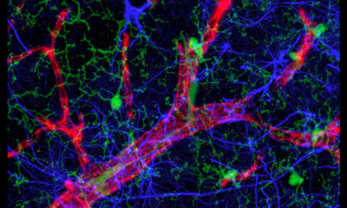 Das Fluoreszenzmikroskopie-Bild zeigt Sternzellen (blau), Blutgefäße (rot) und Immunzellen (grün) aus Gehirn-Gewebsschnitten. Aufnahme: Chun-Xia Yi