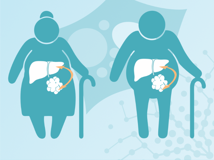 Research_Topic_Lipostasis ©Ariane Pessentheiner