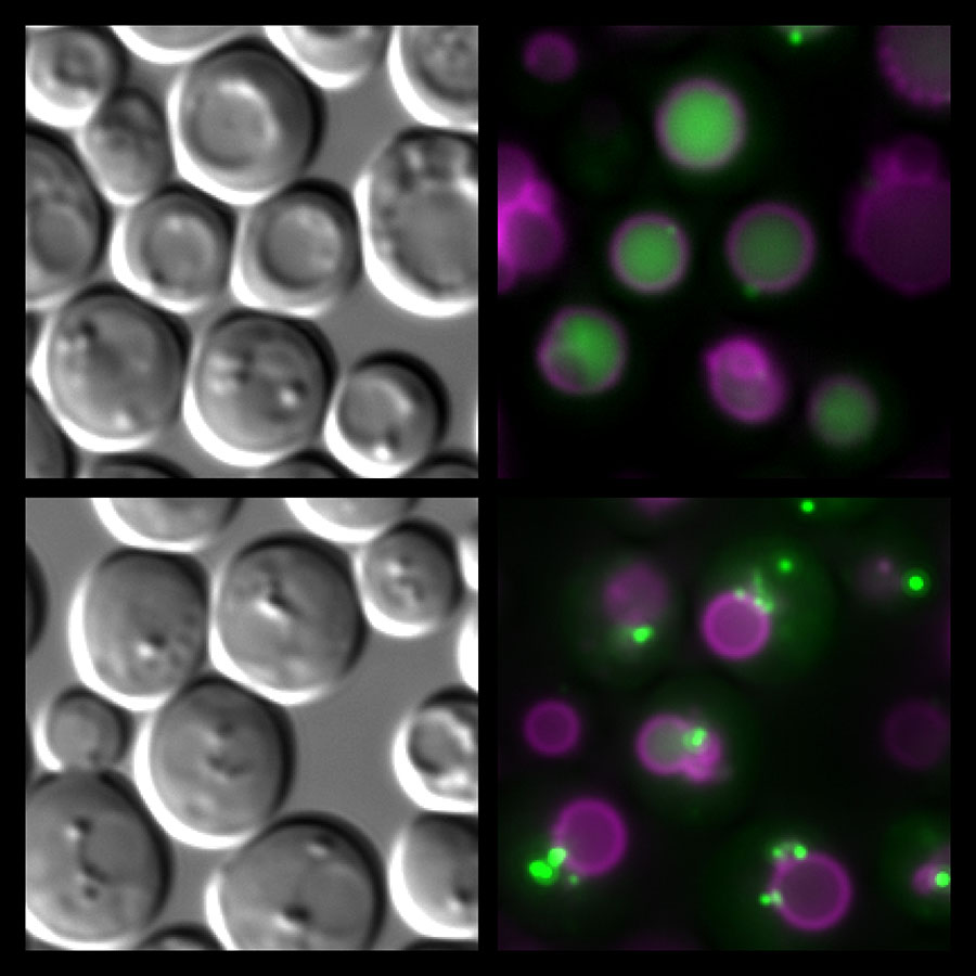 Die Abbildung zeigt alternde Hefezellen im Lichtmikroskop (links). Durch Fluoreszenzfärbungen (rechts) wurde der „Magen“ der Zellen (die sog. Vakuole) sichtbar gemacht (Magenta färbig). In gesunden Zellen können Proteine, die mittels grüner Fluoreszenz markiert wurden, durch Autophagie recycelt werden (oben rechts). Zellen mit gestörtem Fettstoffwechsel (unten rechts) zeigen einen Autophagiedefekt und scheitern beim Transport der grün-markierten Proteine in die Vakuole und Altern schneller. Bild: Uni Graz/Eisenberg 