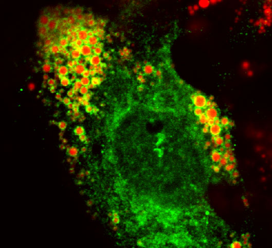 Fluoreszenzmarkiertes G0S2 (grün) auf der Oberfläche von gespeicherten Lipidtröpfchen (rot) in einer kultivierten Herzzelle, aufgenommen mit einem konfokalen Fluoreszenzmikroskop. Foto: Uni Graz/IMB 