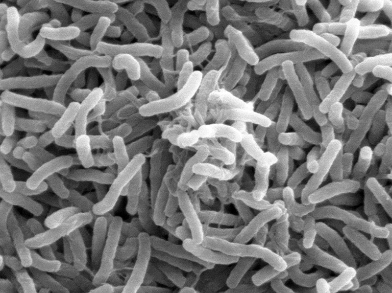 Cholera-Bakterien unter dem Mikroskop: Wie sich die Krankheitserreger Nahrung verschaffen, haben WissenschafterInnen der Uni Graz nun geklärt. Foto: Wikimedia Commons 