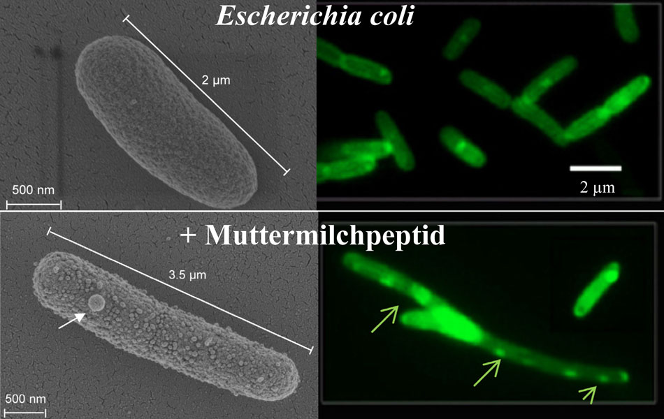 Elektronenmikroskopie (links) und Fluoreszenzmikroskopie (rechts): Aufnahmen von Zellen des Bakteriums Escherichia coli ohne Einwirkung von Peptid (oben) und unter Einwirkung einer mit Fettsäureketten verstärkten Variante des Muttermilchpeptids Lactofer 