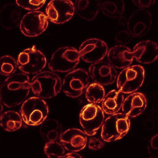 Verschiedene Membrane in Hefe: endoplasmatisches reticulum, Plasmamembran, Plasmamembran plus Vacuole. 