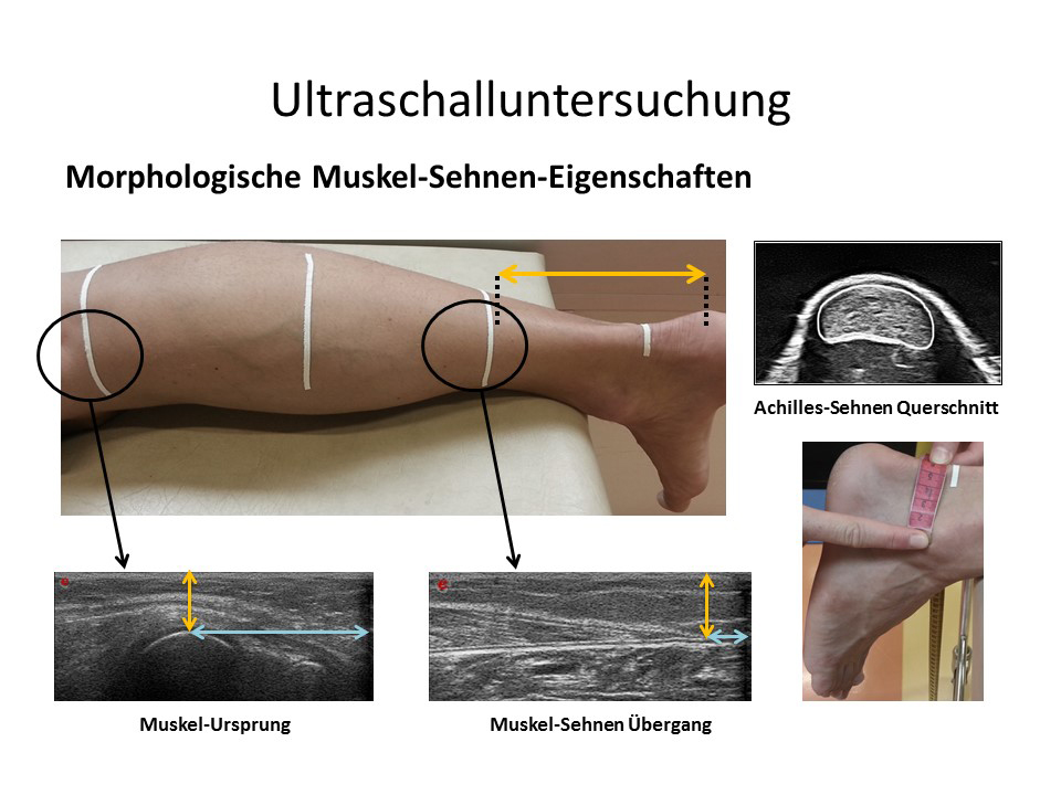 Mithilfe von Ultraschall wurde das elementare Zusammenspiel von Muskel und Sehne beobachtet. Fotos: Uni Graz/Annika Kruse 