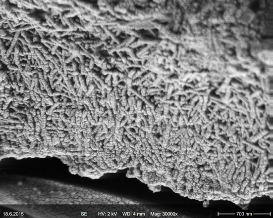Verkalkte Zellwand von Rotalgen mit einem spezifischen Typ von Nanokristallen aus Kalzit, aufgenommen mit dem Rasterelektronenmikroskop. Foto: Uni Graz/Erdwissenschaften 