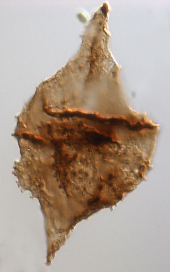 Zyste einer Rotalge der Gattung Rhaetogonyaulax (40 x 60 Mikrometer). Dinoflagellaten waren häufiger, bevor das Massensterben während der späten Trias einsetzte. Foto: Bas van de Schootbrugge. 